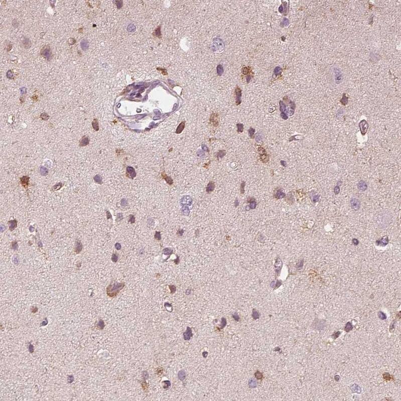 SLC6A17 Antibody - BSA Free Immunohistochemistry-Paraffin: SLC6A17 Antibody - BSA Free [NBP1-86494]