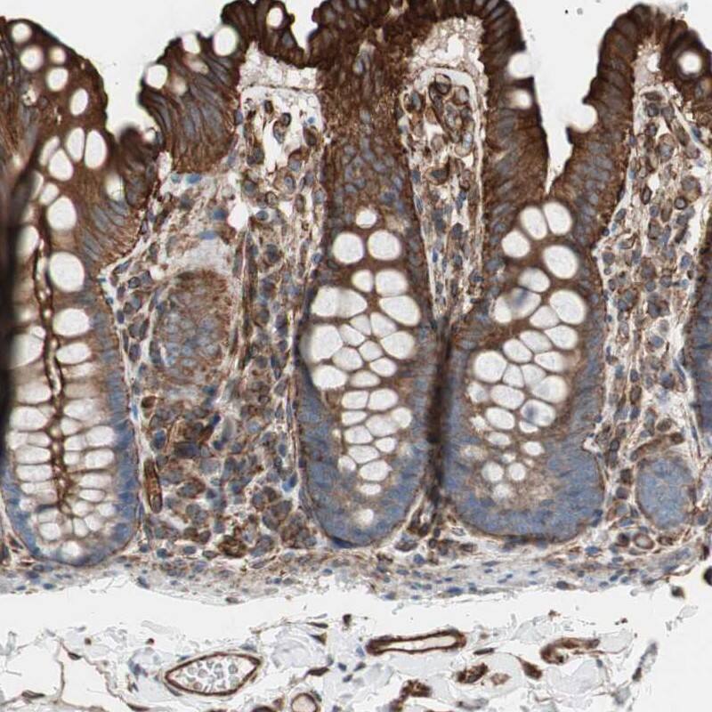 TCTA Antibody - BSA Free Immunohistochemistry-Paraffin: TCTA Antibody [NBP1-86497]