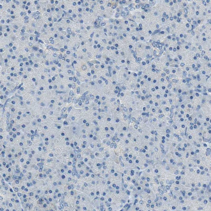 MUC4 Antibody - BSA Free Immunohistochemistry-Paraffin: MUC4 Antibody - BSA Free [NBP1-86505]