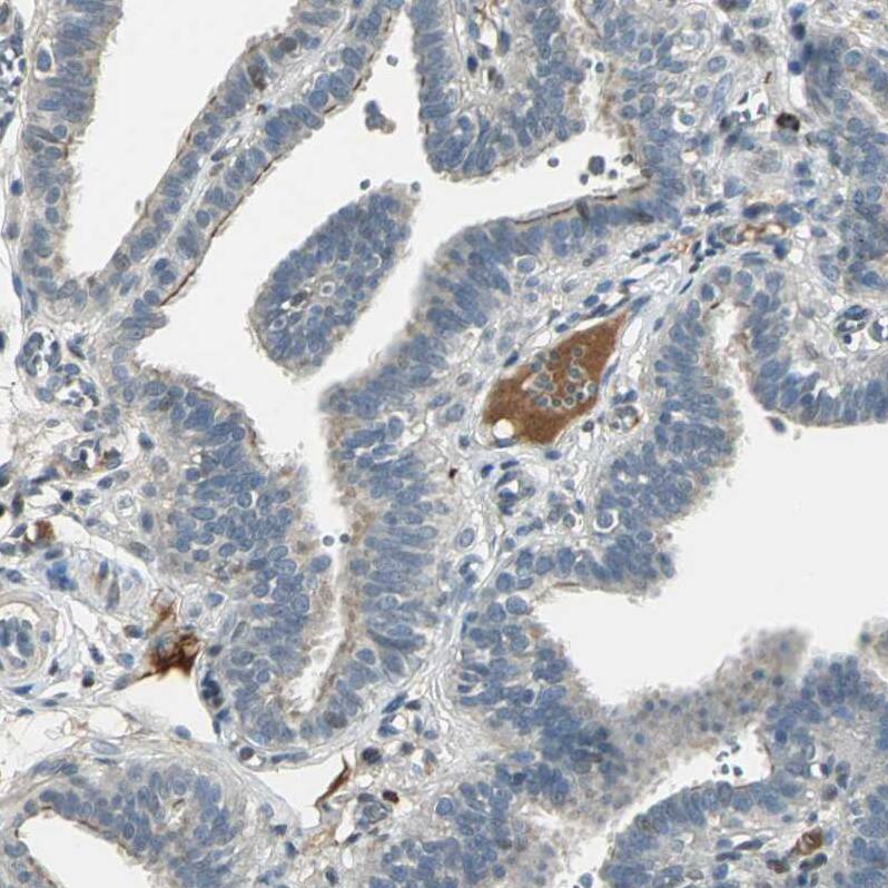 Coagulation Factor XIV/Protein C Antibody - BSA Free Immunohistochemistry-Paraffin: Coagulation Factor XIV/Protein C Antibody - BSA Free [NBP1-86509]