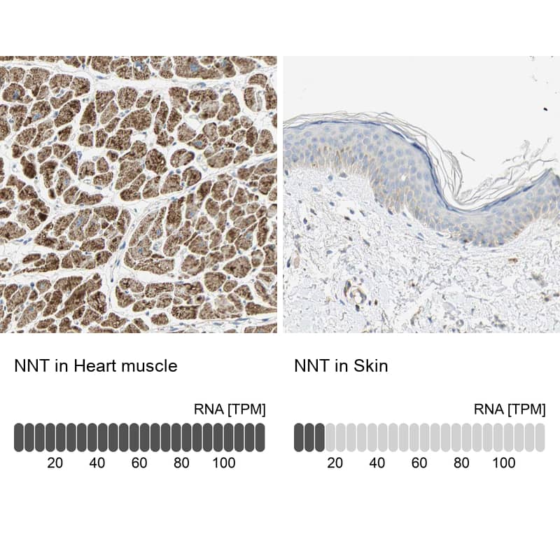 NNT Antibody - BSA Free Immunohistochemistry-Paraffin: NNT Antibody - BSA Free [NBP1-86512]