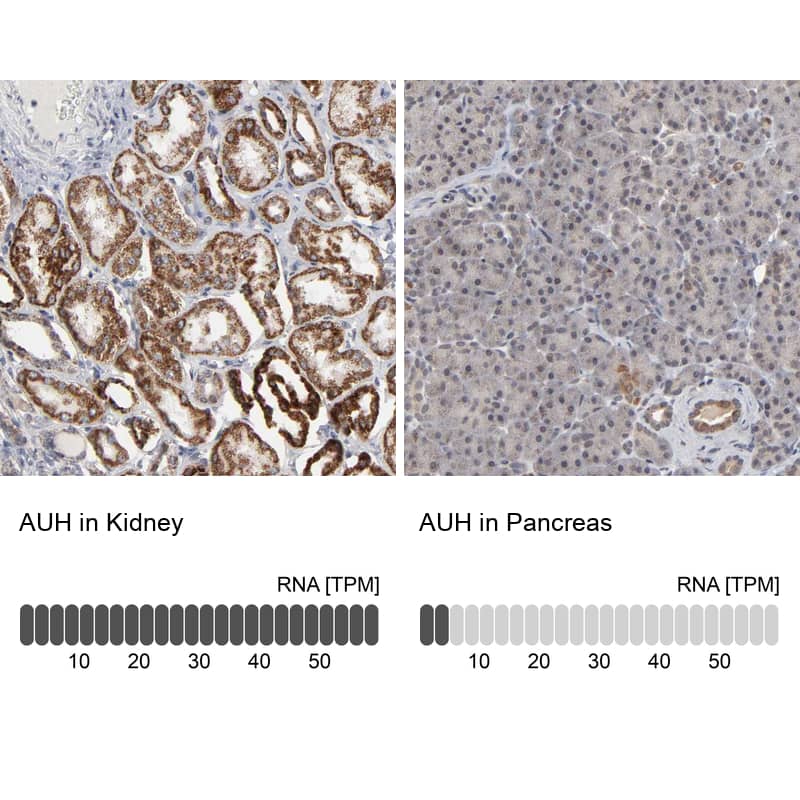 AUH Antibody - BSA Free Immunohistochemistry-Paraffin: AUH Antibody - BSA Free [NBP1-86516]