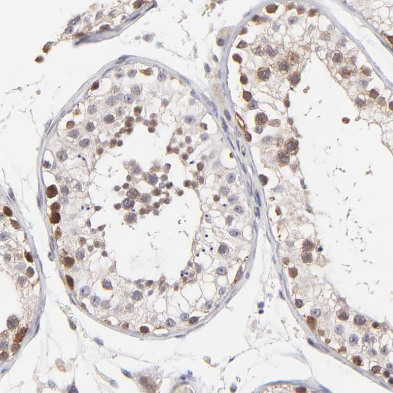 ZNF177 Antibody - BSA Free Immunohistochemistry-Paraffin: ZNF177 Antibody [NBP1-86523]