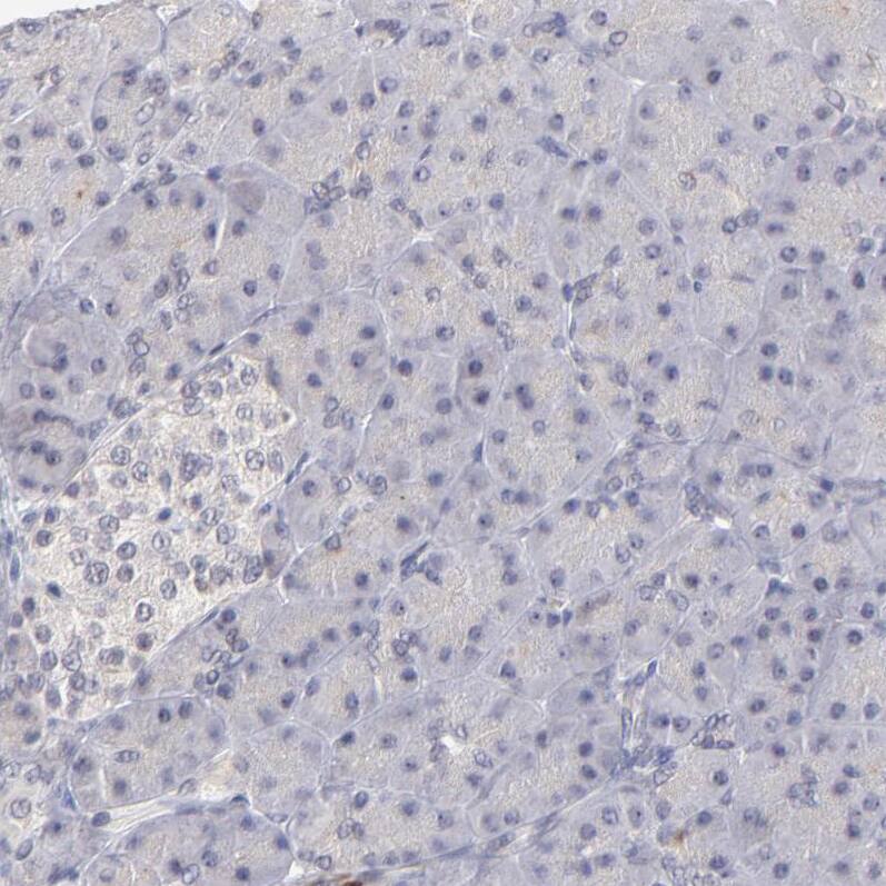 ZNF177 Antibody - BSA Free Immunohistochemistry-Paraffin: ZNF177 Antibody [NBP1-86523]