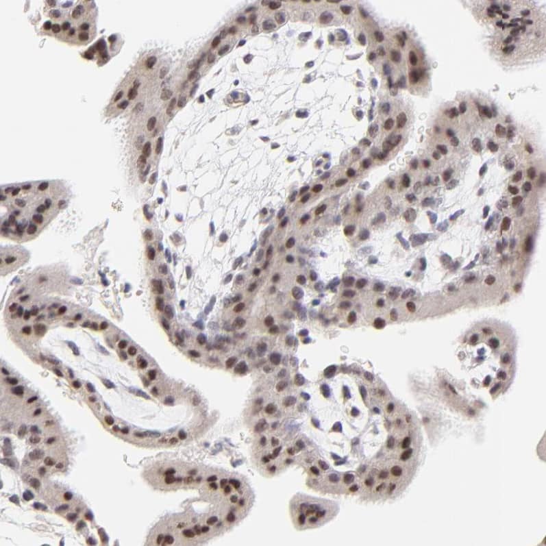 ZNF177 Antibody - BSA Free Immunohistochemistry-Paraffin: ZNF177 Antibody [NBP1-86523]
