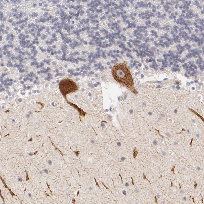 ZNF177 Antibody - BSA Free Immunohistochemistry-Paraffin: ZNF177 Antibody [NBP1-86523]