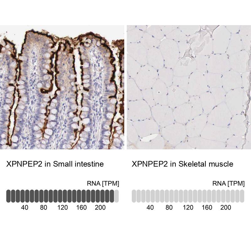 Aminopeptidase P2/XPNPEP2 Antibody - BSA Free Immunohistochemistry-Paraffin: Aminopeptidase P2/XPNPEP2 Antibody - BSA Free [NBP1-86535]