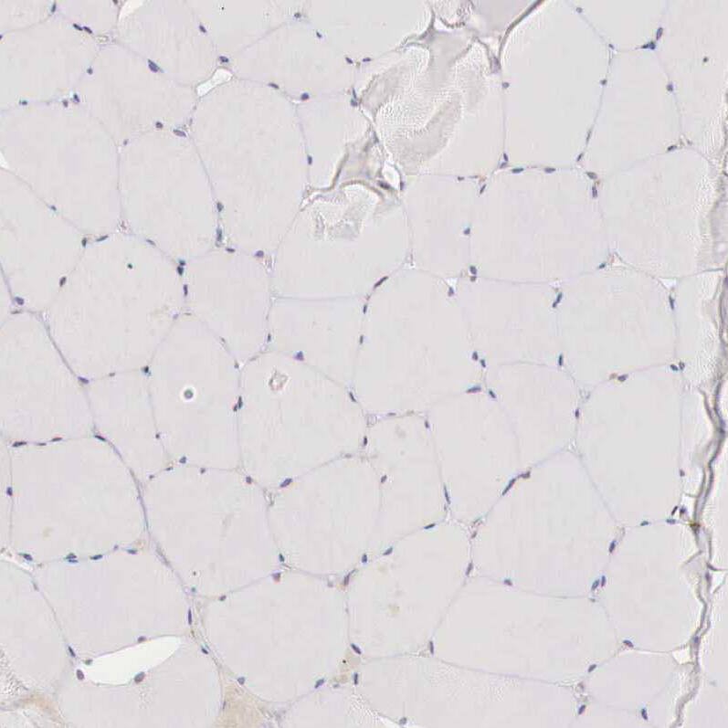 Aminopeptidase P2/XPNPEP2 Antibody - BSA Free Immunohistochemistry-Paraffin: Aminopeptidase P2/XPNPEP2 Antibody - BSA Free [NBP1-86535]