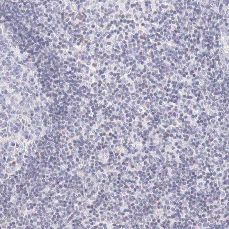 Aminopeptidase P2/XPNPEP2 Antibody - BSA Free Immunohistochemistry-Paraffin: Aminopeptidase P2/XPNPEP2 Antibody - BSA Free [NBP1-86535]