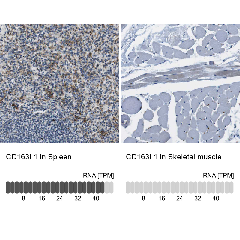 CD163L1 Antibody - BSA Free Immunohistochemistry-Paraffin: CD163L1 Antibody - BSA Free [NBP1-86545]