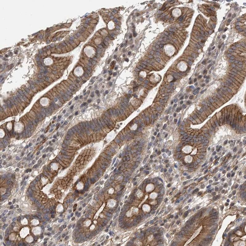 Nectin-1/PVRL1 Antibody - BSA Free Immunohistochemistry-Paraffin: Nectin-1/PVRL1 Antibody - BSA Free [NBP1-86554]