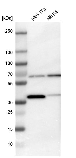CCT3 Antibody - BSA Free Western Blot: CCT3 Antibody - BSA Free [NBP1-86562]