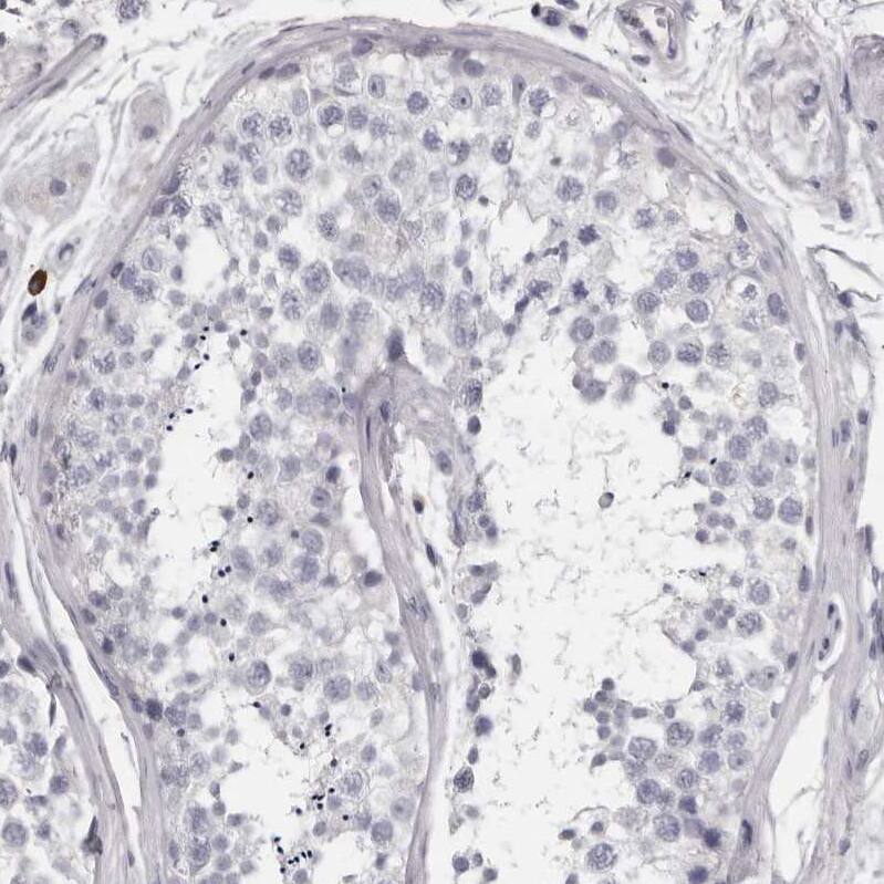 Granzyme H Antibody - BSA Free Immunohistochemistry-Paraffin: Granzyme H Antibody - BSA Free [NBP1-86565]