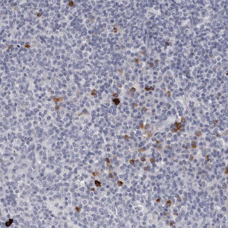 Granzyme H Antibody - BSA Free Immunohistochemistry-Paraffin: Granzyme H Antibody - BSA Free [NBP1-86565]