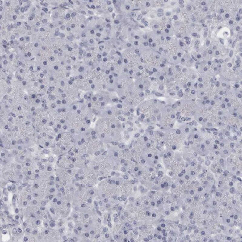Granzyme H Antibody - BSA Free Immunohistochemistry-Paraffin: Granzyme H Antibody - BSA Free [NBP1-86565]