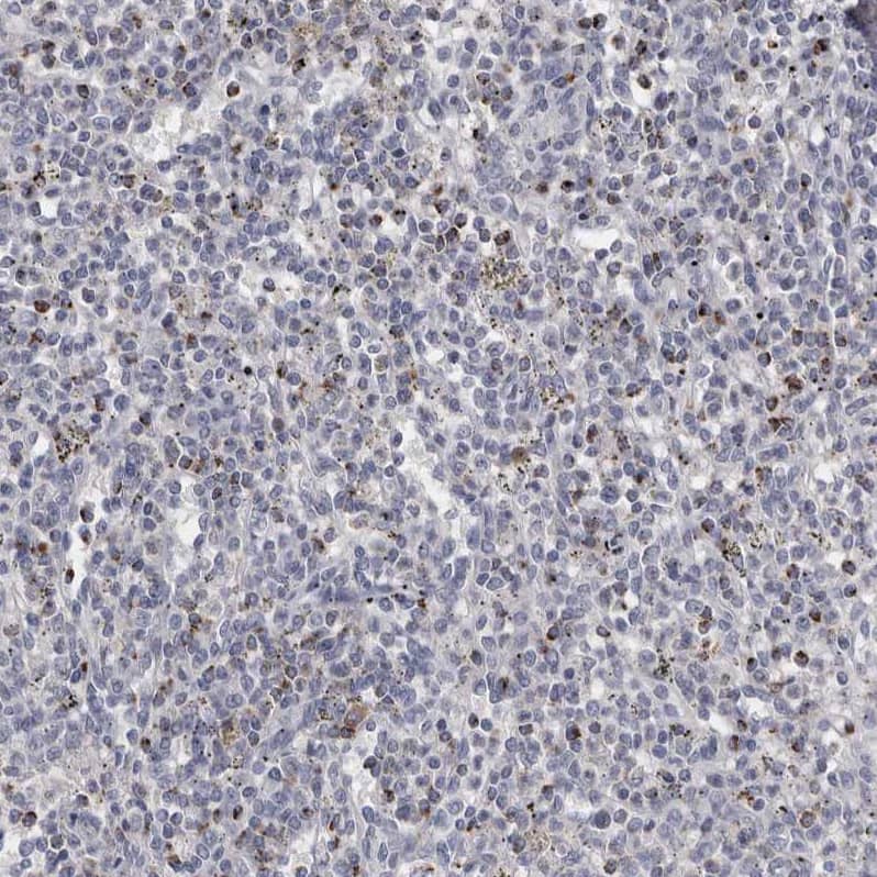 Granzyme H Antibody - BSA Free Immunohistochemistry-Paraffin: Granzyme H Antibody - BSA Free [NBP1-86565]