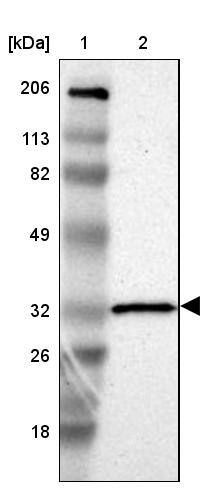 HCCS Antibody - BSA Free Western Blot: HCCS Antibody - BSA Free [NBP1-86577]