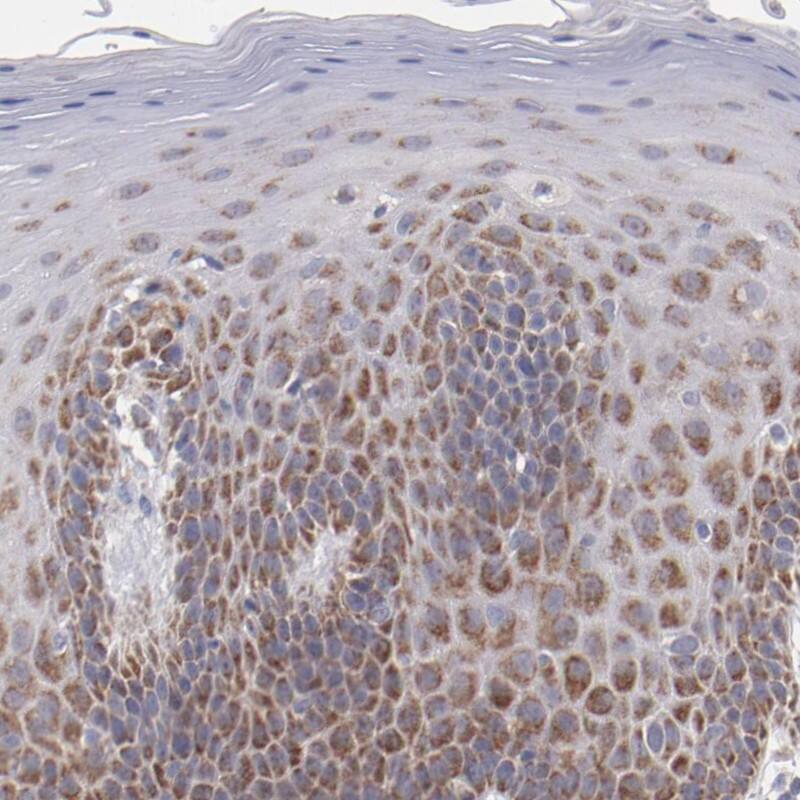 HCCS Antibody - BSA Free Immunohistochemistry-Paraffin: HCCS Antibody - BSA Free [NBP1-86577]