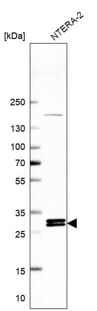 INO80E Antibody - BSA Free Western Blot: INO80E Antibody - BSA Free [NBP1-86578]