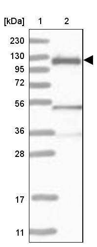CBL Antibody - BSA Free Western Blot: CBL Antibody - BSA Free [NBP1-86588]