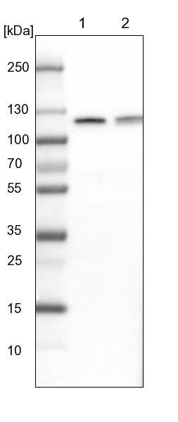 CBL Antibody - BSA Free Western Blot: CBL Antibody - BSA Free [NBP1-86588]