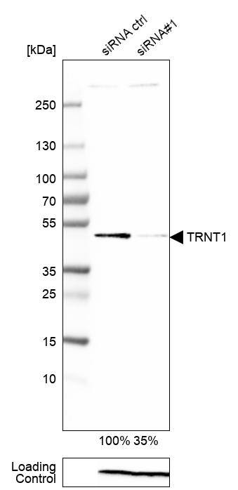 TRNT1 Antibody - BSA Free Western Blot: TRNT1 Antibody - BSA Free [NBP1-86589]