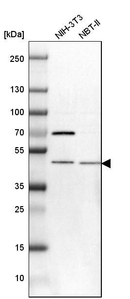 TRNT1 Antibody - BSA Free Western Blot: TRNT1 Antibody - BSA Free [NBP1-86589]