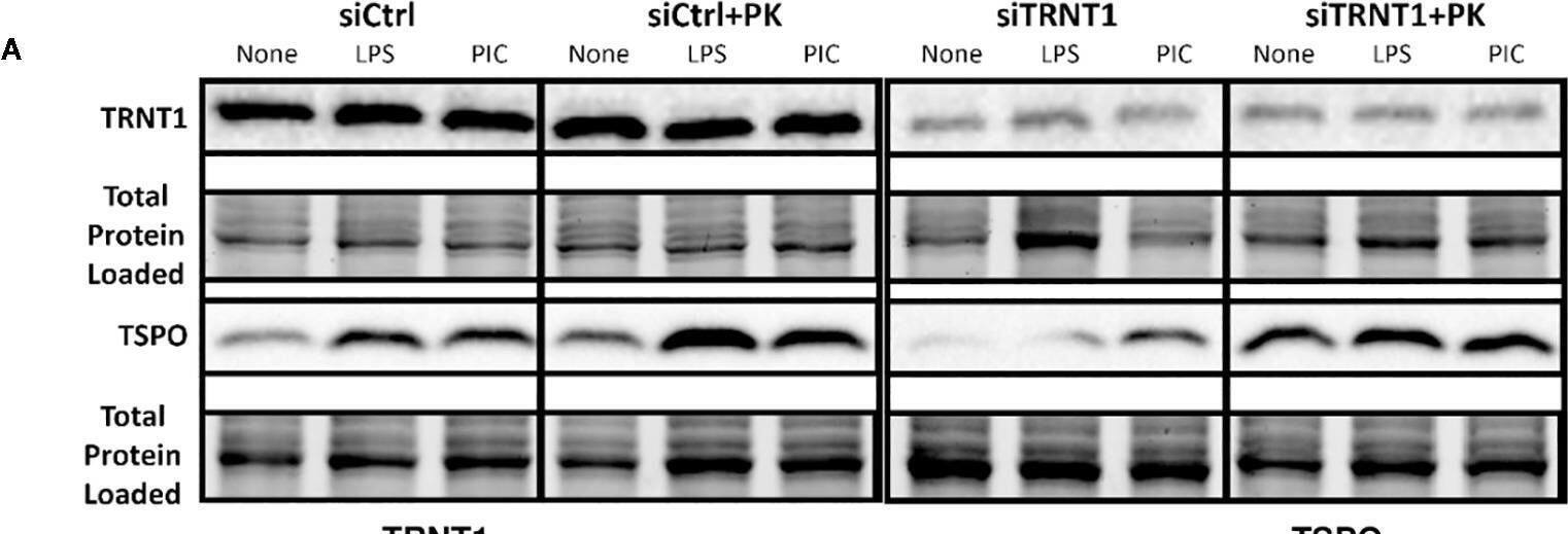 TRNT1 Antibody - BSA Free