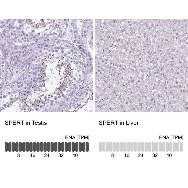 SPERT Antibody - BSA Free Immunohistochemistry-Paraffin: SPERT Antibody - BSA Free [NBP1-86592]