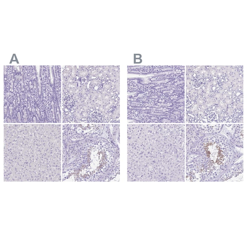 SPERT Antibody - BSA Free Immunohistochemistry-Paraffin: SPERT Antibody - BSA Free [NBP1-86592]