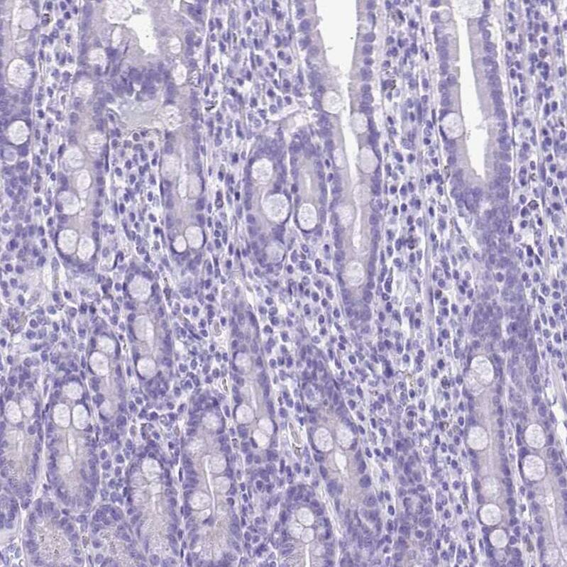 SPERT Antibody - BSA Free Immunohistochemistry-Paraffin: SPERT Antibody - BSA Free [NBP1-86592]