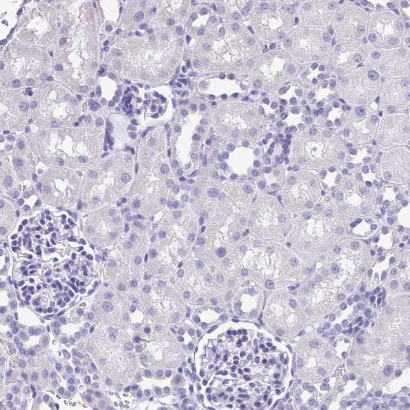 SPERT Antibody - BSA Free Immunohistochemistry-Paraffin: SPERT Antibody - BSA Free [NBP1-86592]