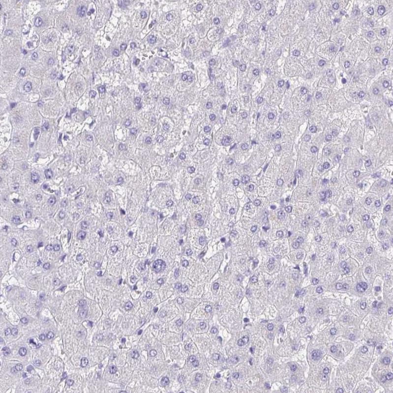 SPERT Antibody - BSA Free Immunohistochemistry-Paraffin: SPERT Antibody - BSA Free [NBP1-86592]