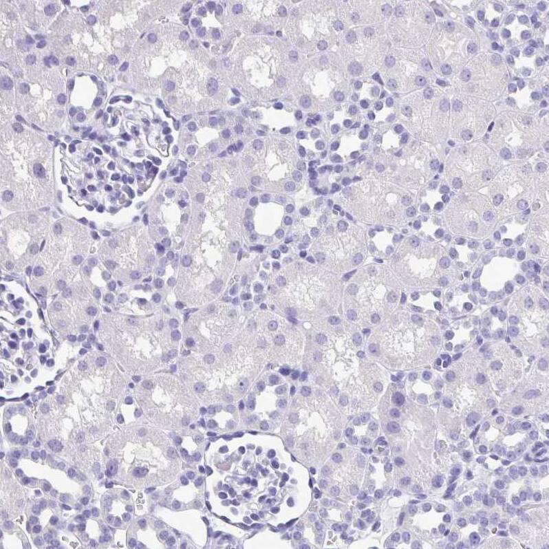 SPERT Antibody - BSA Free Immunohistochemistry-Paraffin: SPERT Antibody - BSA Free [NBP1-86593]