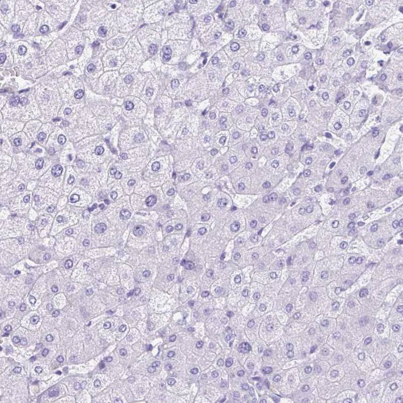 SPERT Antibody - BSA Free Immunohistochemistry-Paraffin: SPERT Antibody - BSA Free [NBP1-86593]