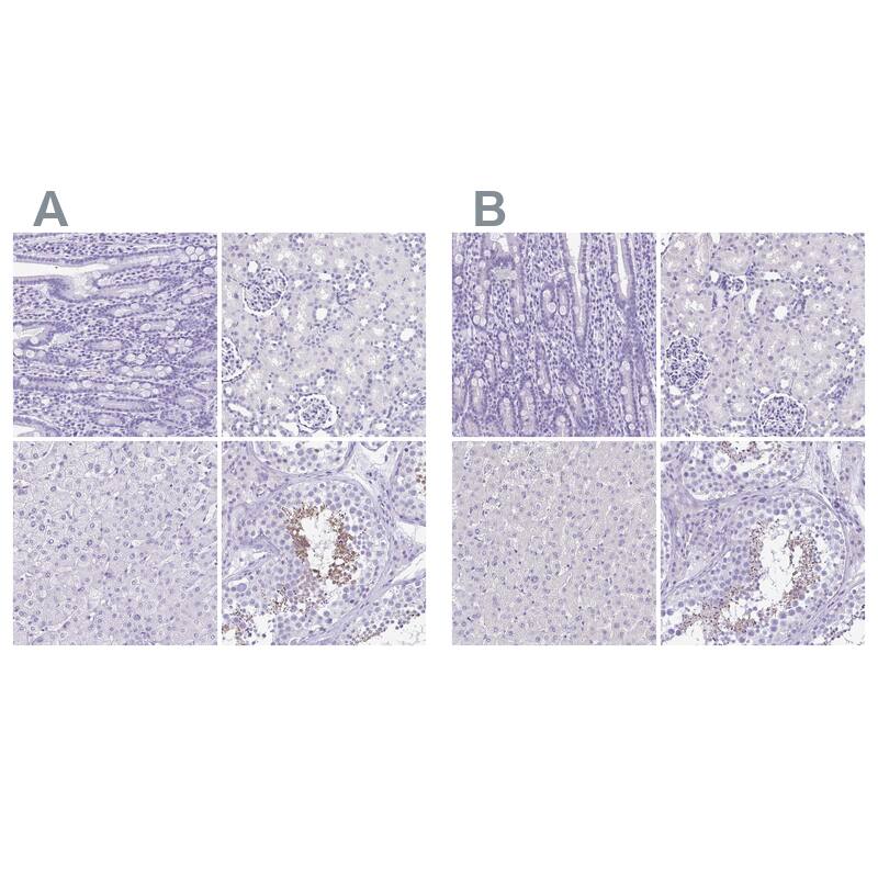 SPERT Antibody - BSA Free Immunohistochemistry-Paraffin: SPERT Antibody - BSA Free [NBP1-86593]