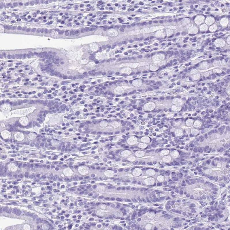 SPERT Antibody - BSA Free Immunohistochemistry-Paraffin: SPERT Antibody - BSA Free [NBP1-86593]