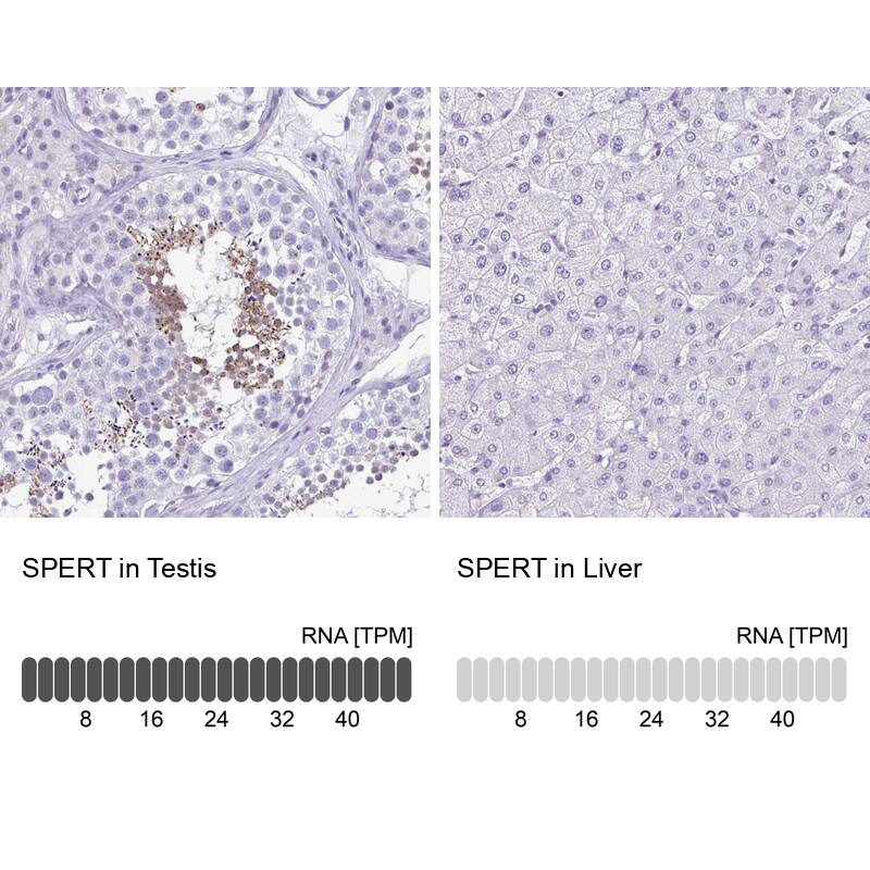 SPERT Antibody - BSA Free Immunohistochemistry-Paraffin: SPERT Antibody - BSA Free [NBP1-86593]