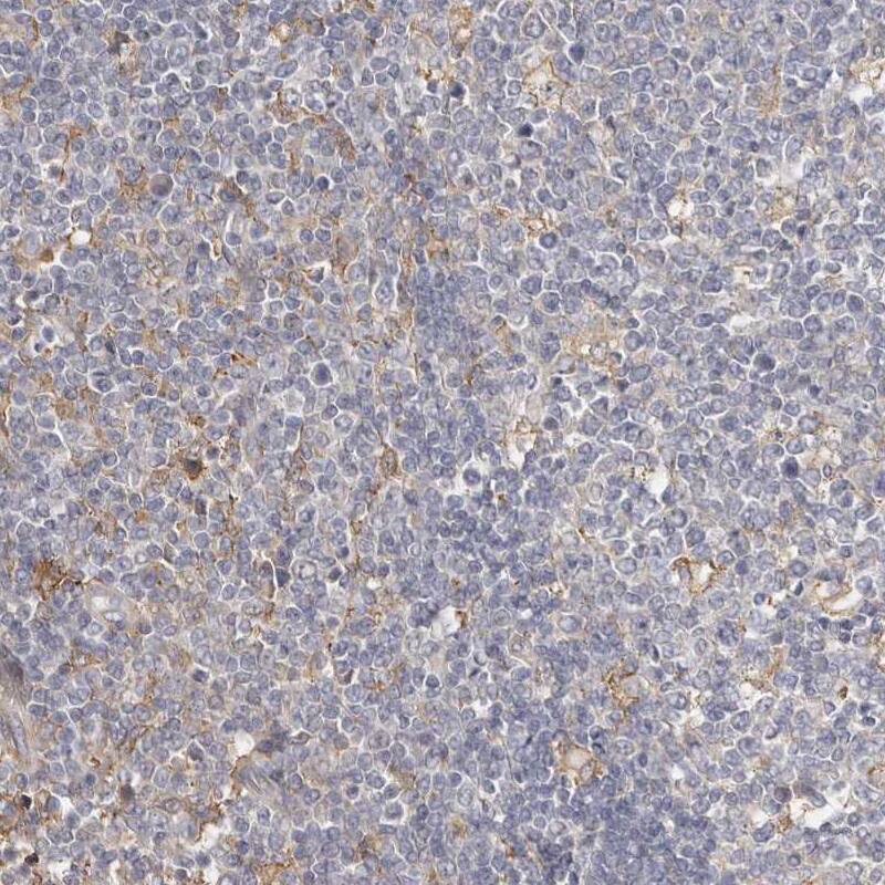 MSRB2 Antibody - BSA Free Immunohistochemistry-Paraffin: MSRB2 Antibody - BSA Free [NBP1-86594]