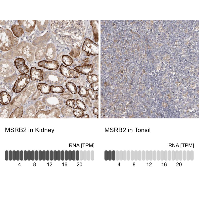 MSRB2 Antibody - BSA Free Immunohistochemistry-Paraffin: MSRB2 Antibody - BSA Free [NBP1-86594]