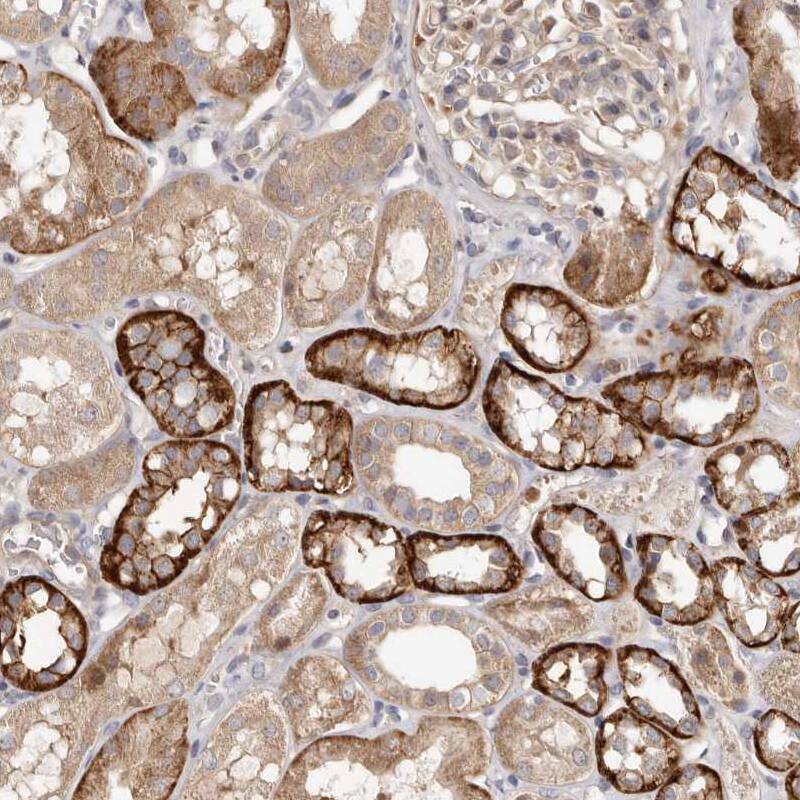 MSRB2 Antibody - BSA Free Immunohistochemistry-Paraffin: MSRB2 Antibody - BSA Free [NBP1-86594]