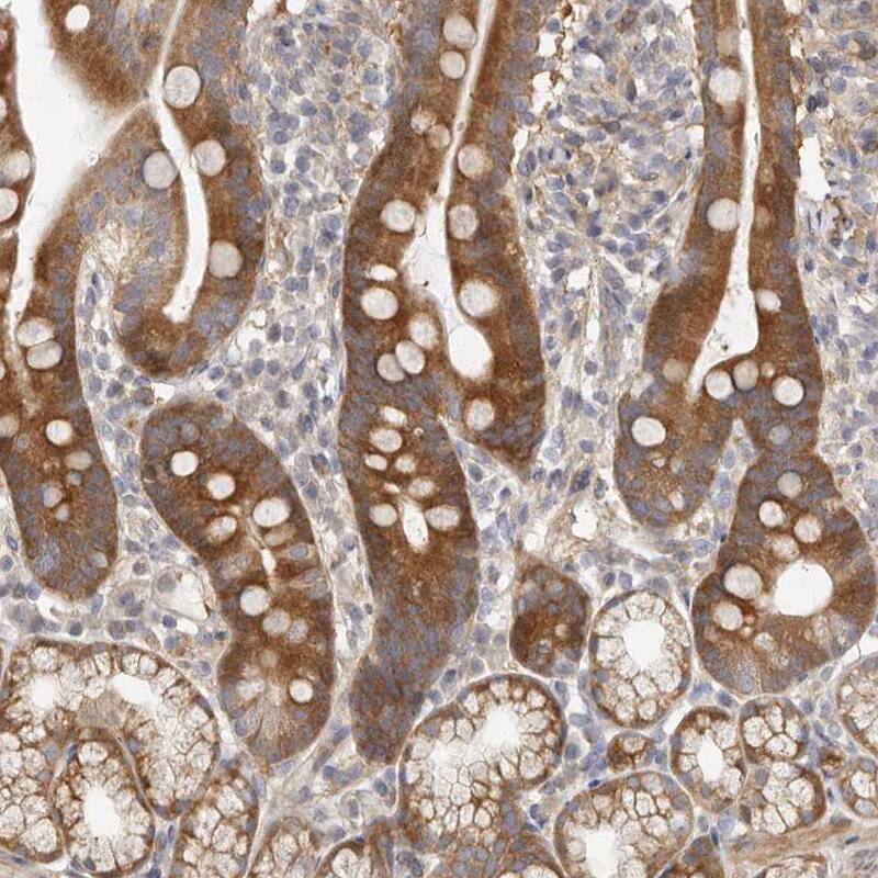 MSRB2 Antibody - BSA Free Immunohistochemistry-Paraffin: MSRB2 Antibody - BSA Free [NBP1-86594]