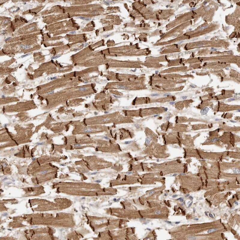 MSRB2 Antibody - BSA Free Immunohistochemistry-Paraffin: MSRB2 Antibody - BSA Free [NBP1-86594]