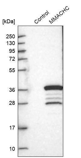 MMACHC Antibody - BSA Free Western Blot: MMACHC Antibody - BSA Free [NBP1-86597]