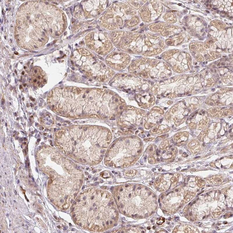 MMACHC Antibody - BSA Free Immunohistochemistry-Paraffin: MMACHC Antibody [NBP1-86598]