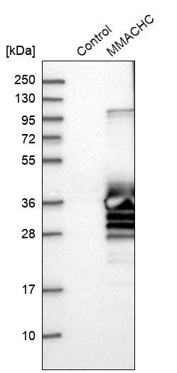 MMACHC Antibody - BSA Free Western Blot: MMACHC Antibody - BSA Free [NBP1-86598]