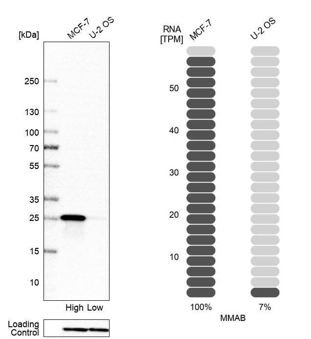 MMAB Antibody - BSA Free Western Blot: MMAB Antibody - BSA Free [NBP1-86602]