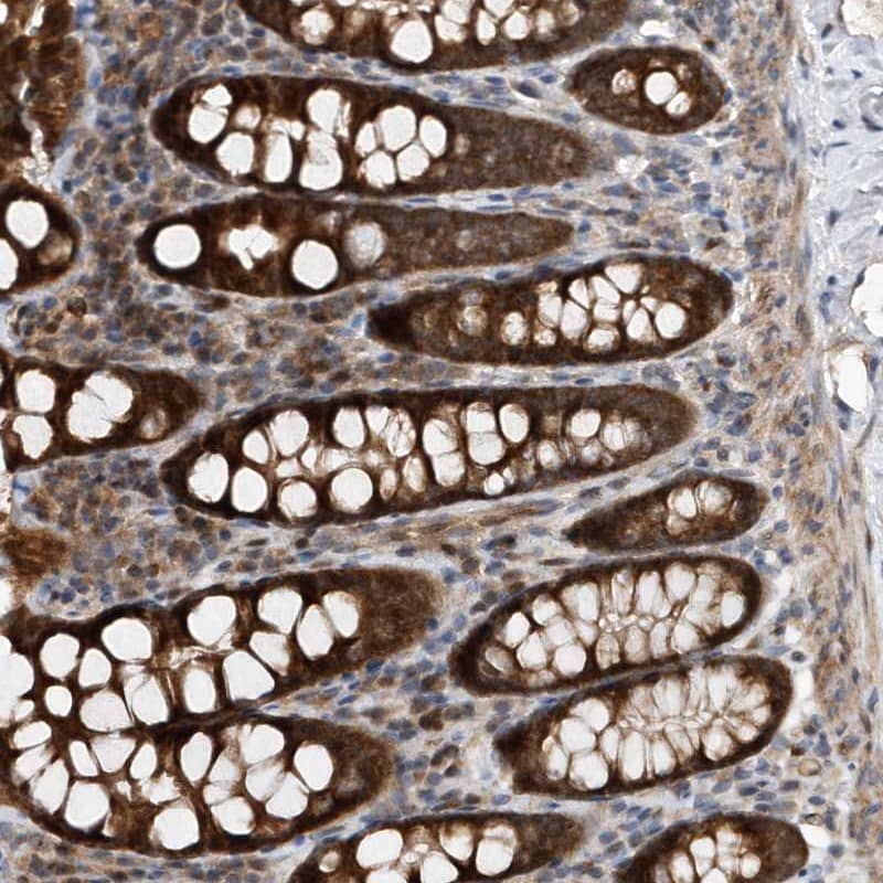 MMAA Antibody - BSA Free Immunohistochemistry-Paraffin: MMAA Antibody [NBP1-86603]