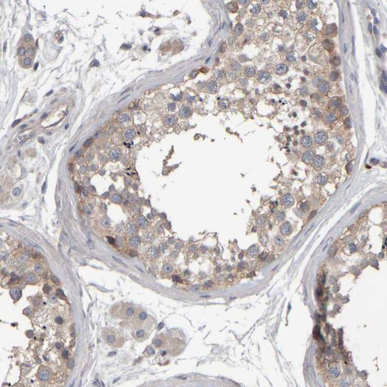MURC Antibody - BSA Free Immunohistochemistry-Paraffin: MURC Antibody - BSA Free [NBP1-86607]