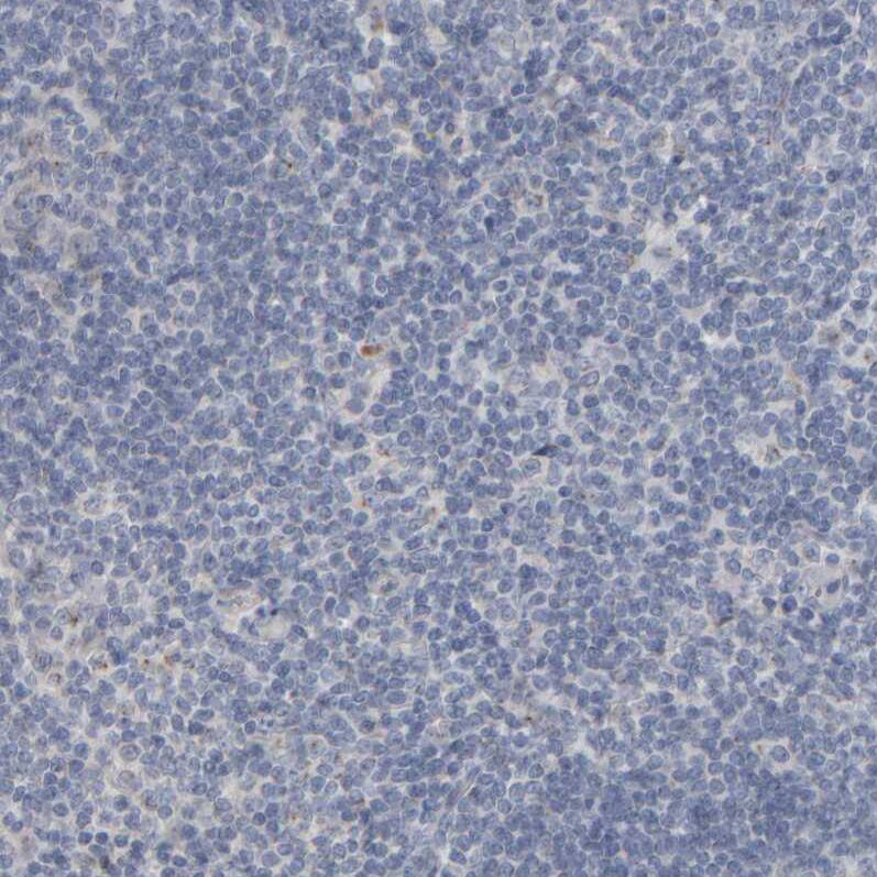 MURC Antibody - BSA Free Immunohistochemistry-Paraffin: MURC Antibody - BSA Free [NBP1-86607]